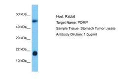 HSPC014 Rabbit anti-Human, Polyclonal, Novus Biologicals 0.1ml; Unconjugated:Antibodies,